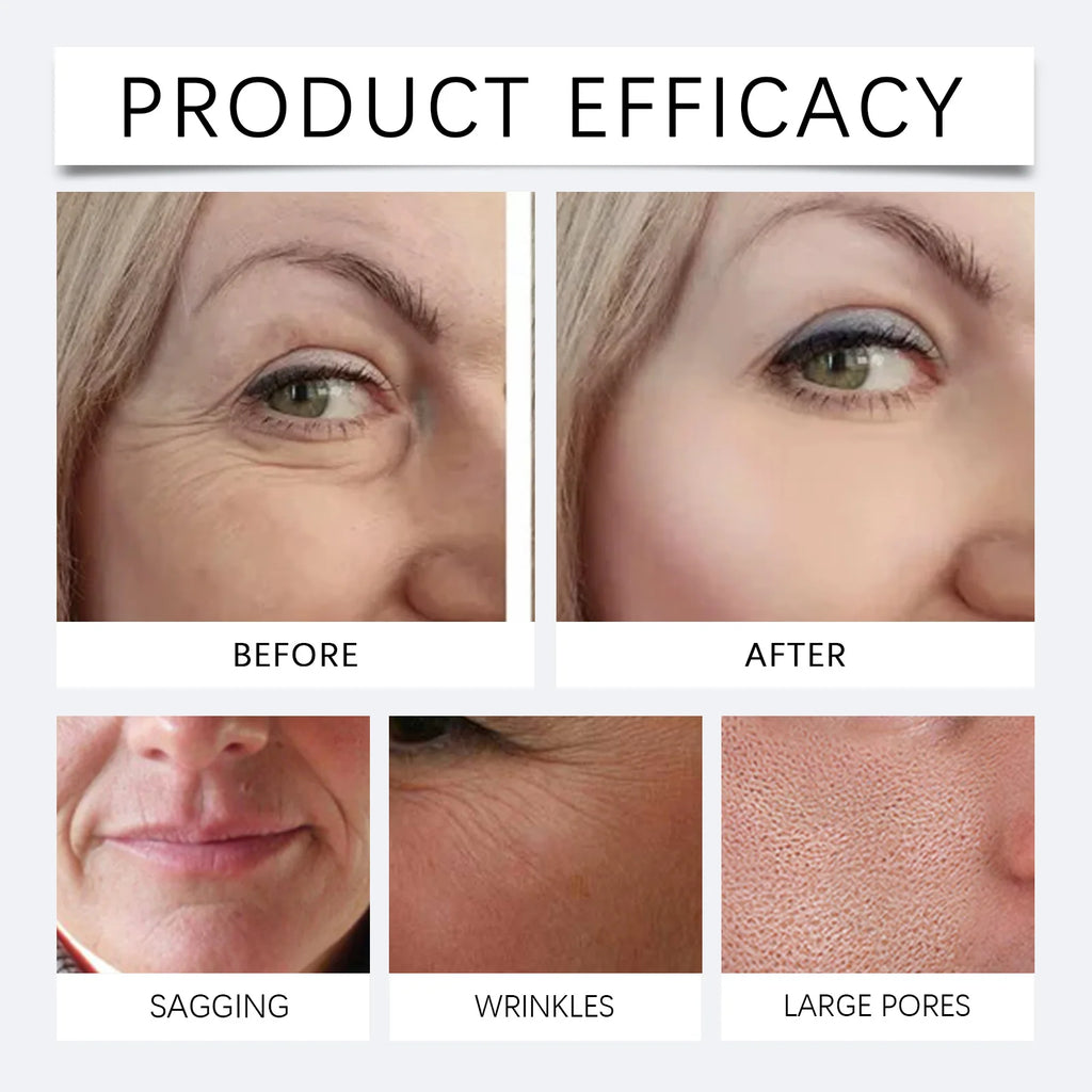 eelhoe Collagen Face Mask 🌟 — Anti-Wrinkle, Radiance, Hyaluronic Acid & Niacinamide | 1 or 3 pcs