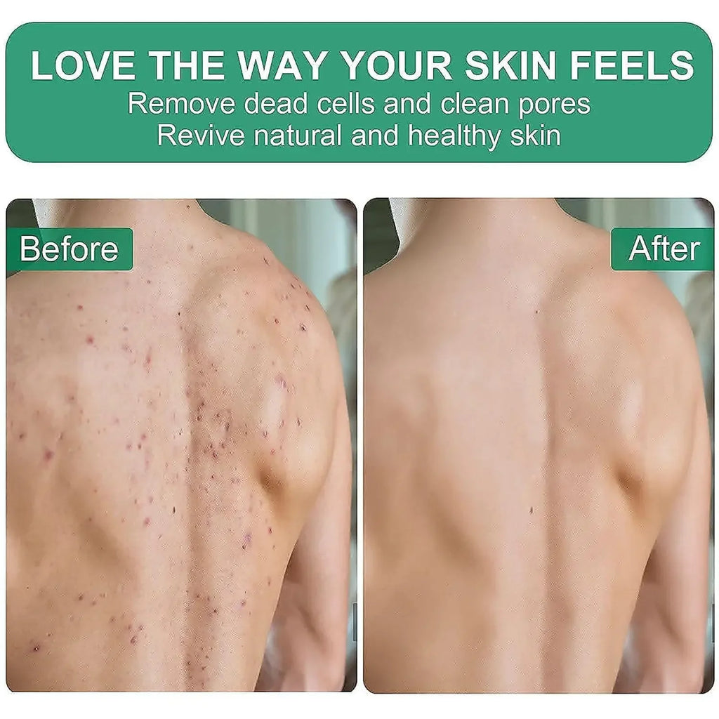 1 unidad de guante exfoliante profundo - Guante de fibra 100% viscosa para limpiar la piel y eliminar la piel muerta y la suciedad