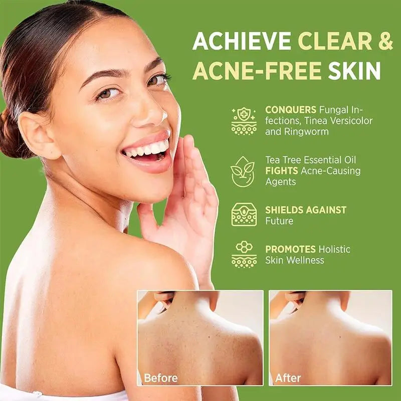 Jabón de aceite de árbol de té para hombres y mujeres, jabón artesanal de extracto vegetal natural, limpieza profunda, calmante para piel seca, exfoliante, cuidado de la piel