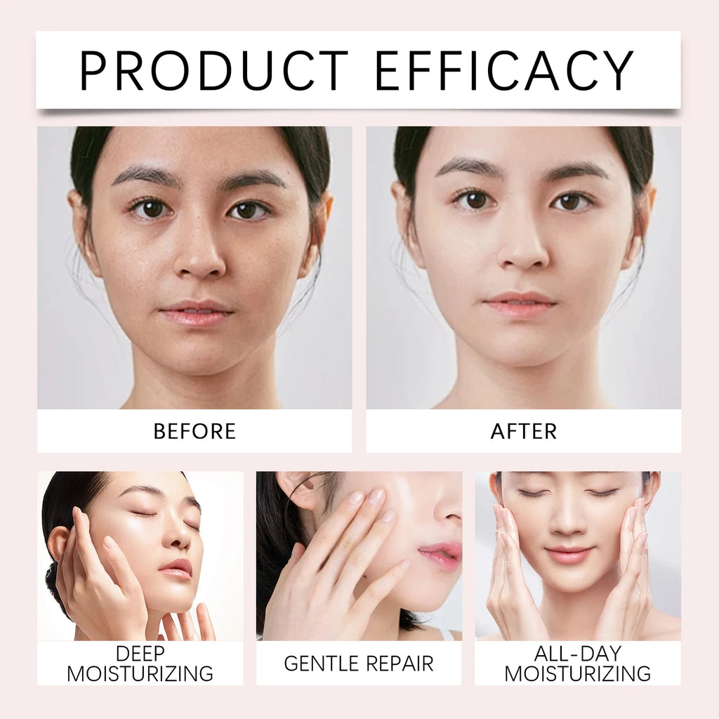 Eelhoe Rose PDRN Collagen Cream Capsules 🌸 — Anti-Wrinkle, Firming & Brightening Complexion 55g
